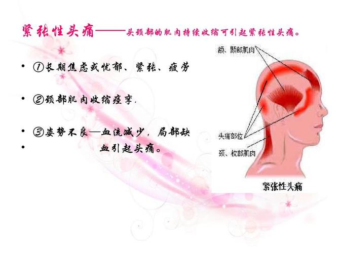 中医头痛辨证分型ppt
