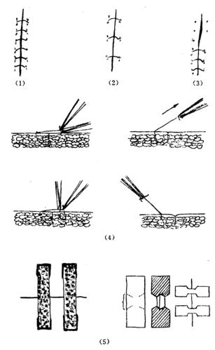图20—9 拆线的方法和步骤