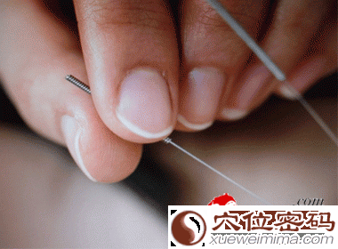 针灸丰胸疗效好 副作用小更安全
