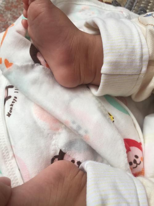 宝宝脚掌内侧靠脚后跟位置有对称突出疙瘩