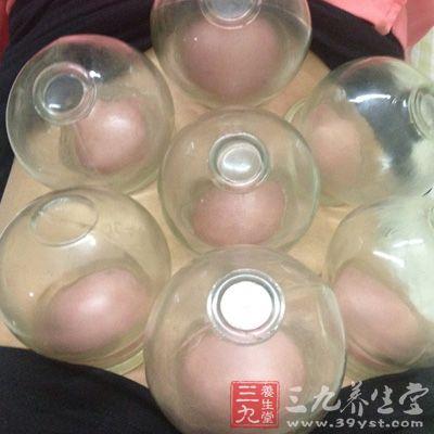 拔罐的作用 拔罐如何治疗腹痛