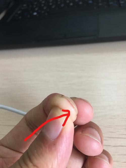 为什么头经常痒,用指甲用力一掐会有一点点水脓被挤出来,我拍了照片还