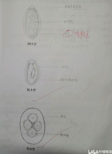 鞭虫,蛲虫,钩虫卵