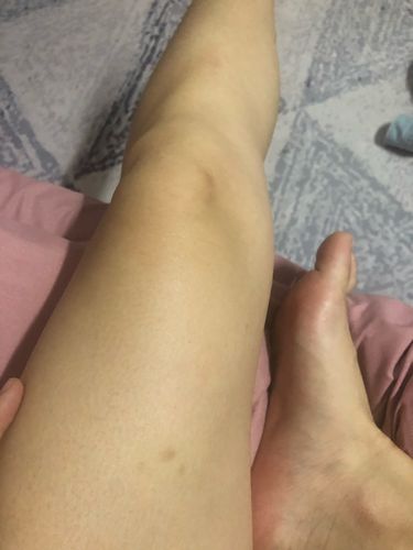 按到我脚淤青!第二天醒来尾龙骨位置巨疼,什么辣鸡美容培训师?