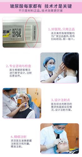 法思丽玻尿酸 高性价比大分子 玻尿酸隆鼻/隆下巴 填充塑形