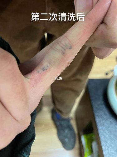 纹身洗得好不好还是要看效果图_纹身_北京大学_洗纹身