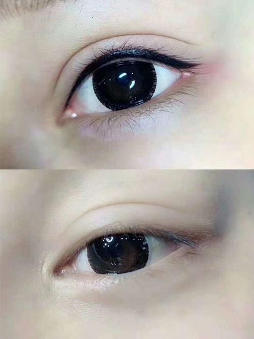 美瞳线对比图