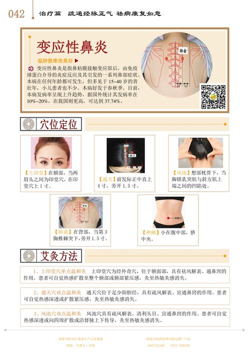 热敏灸中医书