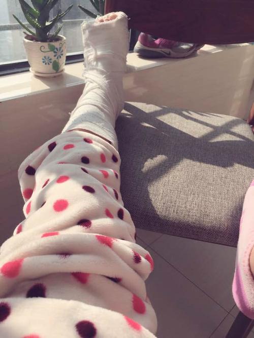 我在7月20日下夜班把脚崴了,韧带轻度拉伤,打了石膏,请问现在我能不能