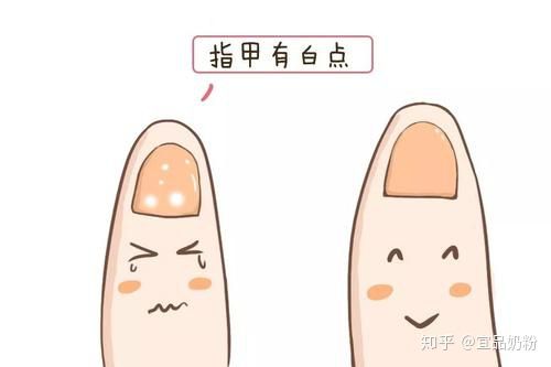 育儿宝宝的五大指甲现象你真的会看吗