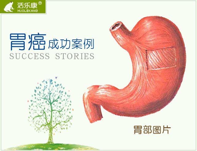 胃癌成功案例