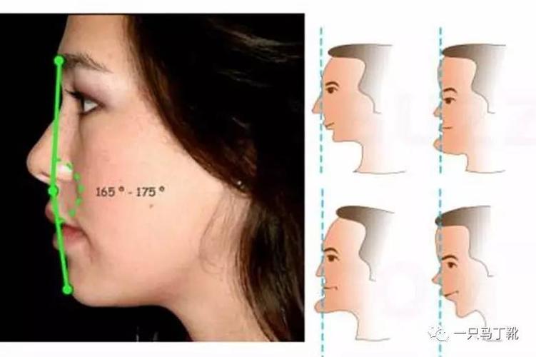 轻微凹面型的嘴唇往往会比较薄.▼