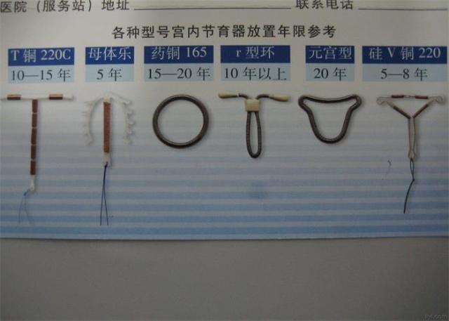 如何正确认识「节育环」,它是如何避孕的,有哪些优缺点?