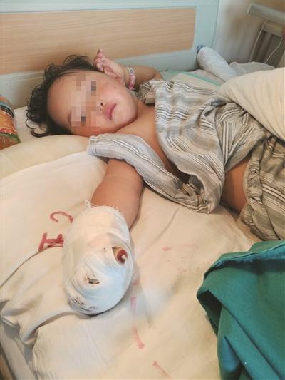 女童右手被绞肉机"吞食" 千余网友为她众筹治疗费用