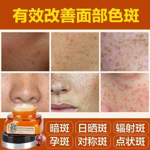 男女士去黄褐斑日晒斑雀斑老年斑产品 50g 美康粉黛美白祛斑霜正品