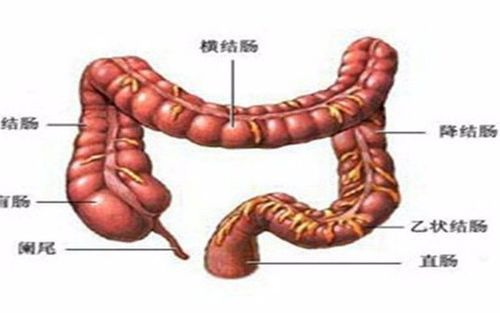 为什么医生总劝你做肠镜结直肠癌现状触目惊心你了解吗