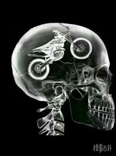 我老婆说我最近神神叨叨的,怕我脑子出问题,给我做了个脑ct