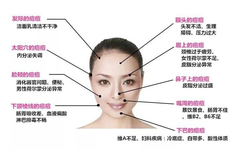 右边脸颊长痘 原因:肺功能失常 改善:注意保养呼吸道,尽量避免芒果