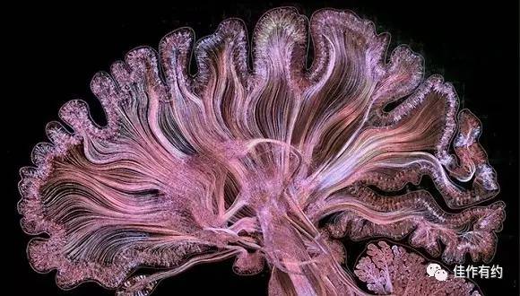 把大脑放到显微镜下,居然这么美