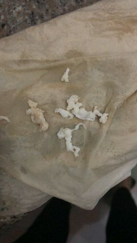 之前有盆腔积液和阴道炎