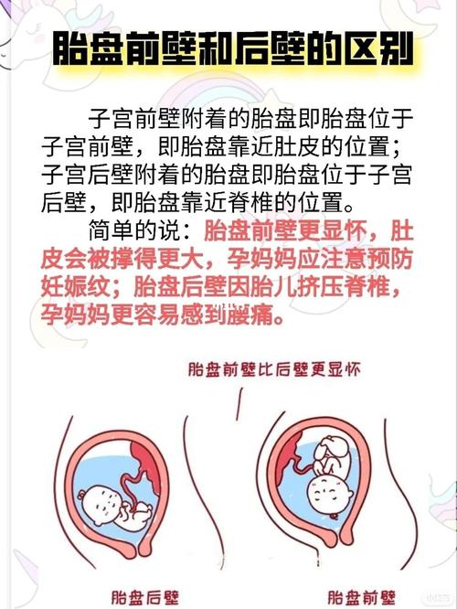 胎盘_子宫_孕妈_胎儿_孕妇_母婴_孕产经验