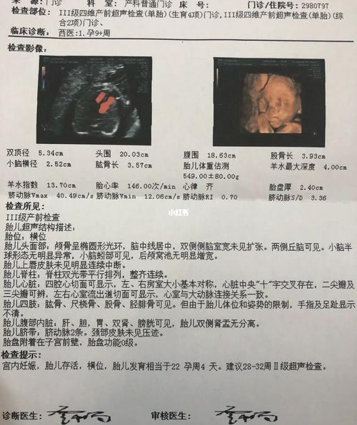 孕期四维_四维彩超_孕期_四维彩超照_母婴_孕产经验