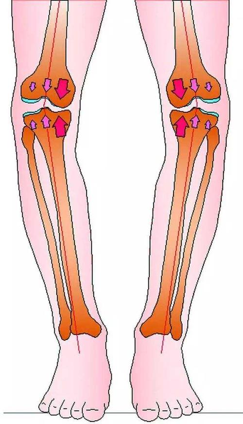 感觉膝盖正面疼痛,而且下蹲时也很疼.