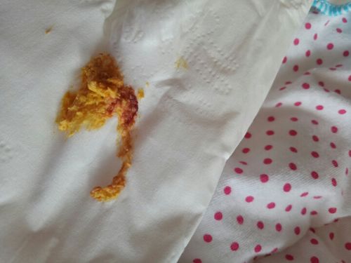 今天儿子满月早上拉便便时有点红色的东西最后拉的还有一点果