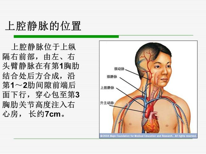 上腔静脉阻塞综合症的护理.ppt