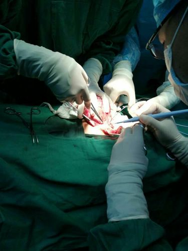 睾丸肿瘤切除术