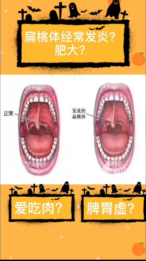 发炎_儿童扁桃体腺样体肥大_母婴_育儿经验