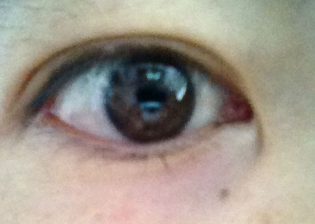 每个人双眼内角(鼻侧)都有一个对称的粉红色的小凸起,叫"泪阜",人类