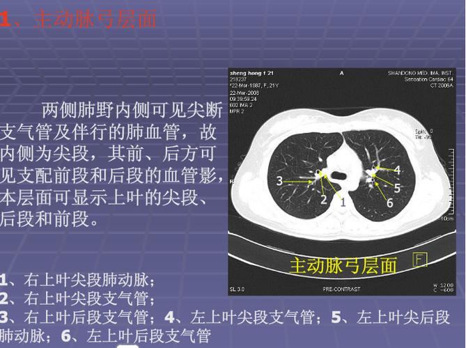 正常胸肺部ct影像学