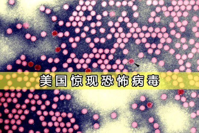 美国境内又发现恐怖病毒家喻户晓到底有多恐怖