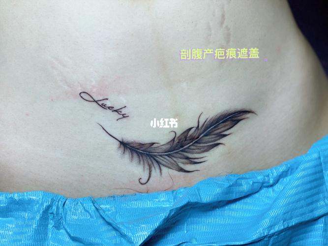 羽毛遮盖剖腹产疤痕#昆山飞鹰纹身_纹身_疤痕_剖腹产