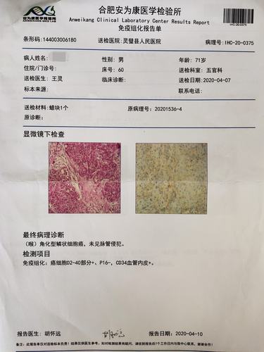 喉部恶性肿瘤(t3n0m0)一例病例报告