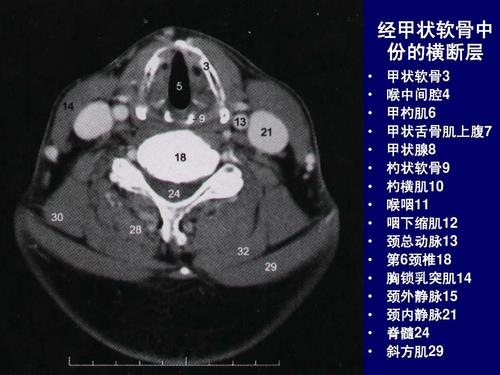 人体断层解剖学-颈部断层解剖
