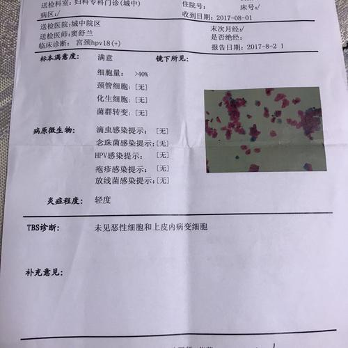 大家好,我也是最近去体检发现hpv18型阳性,医生建议我做了活检,有两