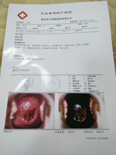 我宫颈糜烂,请帮我看看单子