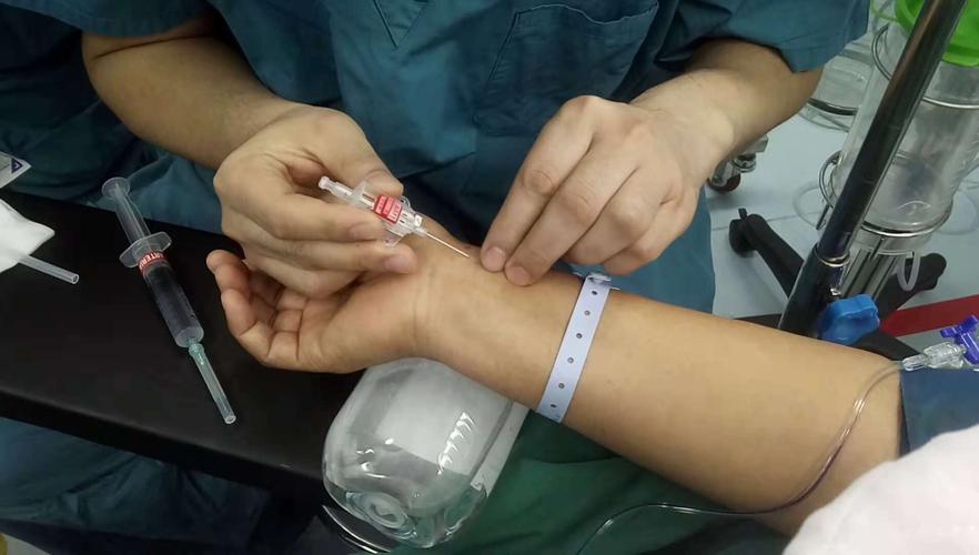 桡动脉穿刺置管,用以监测患者实时血压变化.