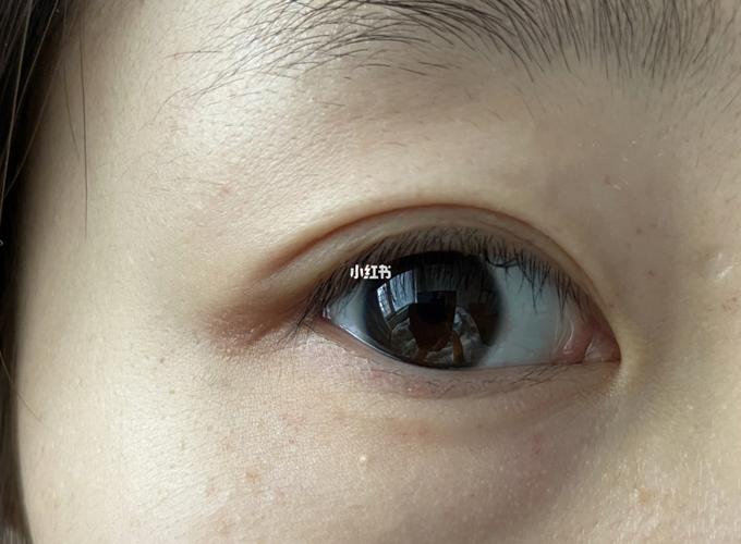 求助眼周围起了很多小红点_护肤_美妆_护肤_护肤其他