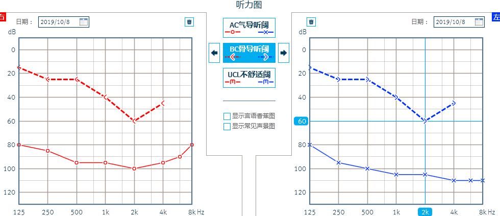 健耳听力助听器,株洲助听器,助听器