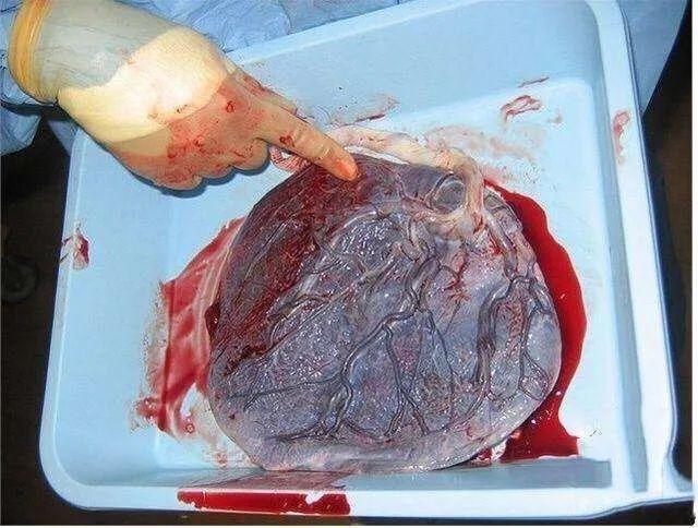 除了与众不同的分娩方式,丫头还注意到, 谢依霖还把「胎盘」拓印下来