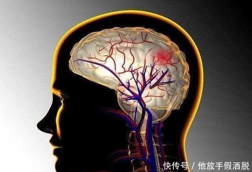 脑供血不足的人,身体常会出现3个症状,当心血管堵塞