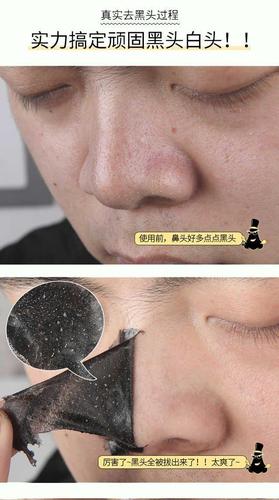 【去黑头粉刺 收缩毛孔】撕拉面膜鼻贴去黑头鼻膜毛孔鼻膏祛粉刺