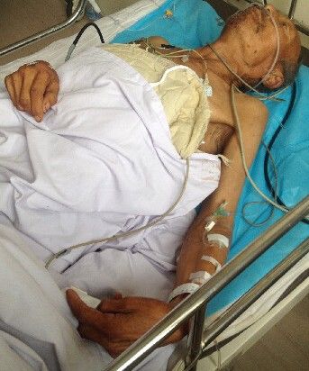 被割睾丸老人:以为嫌犯开玩笑就同意割了