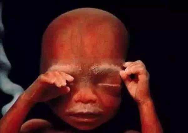 18周,大约14厘米,胎儿已经可以听到外面的声音了 20周,20厘米左右