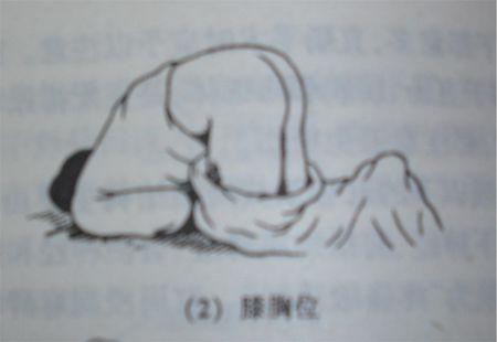 什么叫"膝胸位"