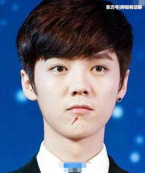 鹿晗面部颧骨扭曲,网友:整容已到期,要回炉重造了