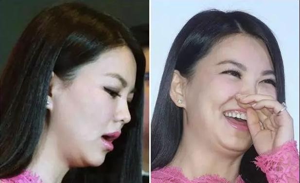 它决定了你99%的气质 还有些人下巴有很多赘肉,看起来就像没有脖子